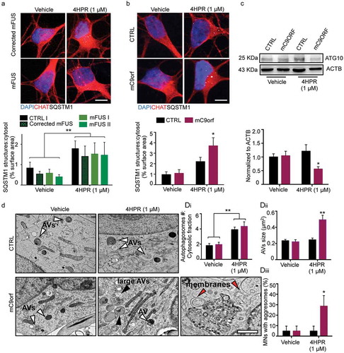 Figure 6. 4HPR leads to ATG10 downregulation and aggresome accumulation in mC9orf MNs. (a and b) Representative confocal images of corrected mFUS (a); CTRL and mC9orf (b) MNs at DIV14 treated with vehicle or 4HPR (1 μM) for 24 h and immunolabeled against CHAT and SQSTM1. 4HPR does not trigger SQSTM1 accumulation in FUS-mutant MNs; in contrast, it induces a strong SQSTM1 accumulation in mC9orf (two-way ANOVA followed by Holm-Sidak´s multiple comparisons test; *p < 0.05). (c) Immunoblot analysis of endogenous ATG10 protein levels in CTRL and C9orf72 (C9orf) MNs at DIV14 treated with vehicle or 4HPR (1 μM) for 24 h (two-way ANOVA followed by Holm-Sidak´s multiple comparisons test: *p < 0.05). (d) TEM analysis of CTRL and mC9orf72 MNs at DIV14 treated with vehicle or 4HPR (1 μM) for 24 h. 4HPR increases in both genotypes the number of AVs (two-way ANOVA followed by Holm-Sidak´s multiple comparisons test; **p < 0.01), which are larger (black arrowheads) in mC9orf MNs (two-way ANOVA followed by Holm-Sidak´s multiple comparisons test; **p < 0.01). 4HPR eventually leads to accumulation of aggresomes in mC9orf MNs (two-way ANOVA followed by Holm-Sidak´s multiple comparisons test; *p < 0.05). Red arrowheads indicate double-membrane structures associated to high-sized AVs and aggresomes. Data information: immunocytochemistry was performed in N = 3 independent replicates and a minimum of n = 60 CHAT+ cells were analyzed. TEM analysis was performed in a minimum of n = 21 MNs from N = 2 independent replicates. Scale bars: (a and b) 10 μm, (d) 1 μm. Data are presented as mean ± SEM.