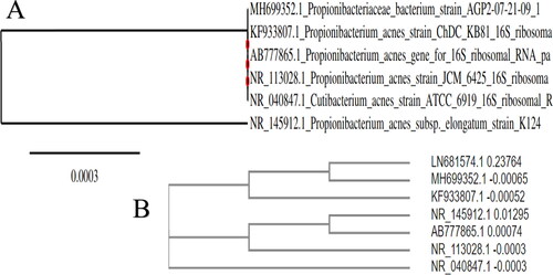 Figure 3. Unrooted tree type of P. acnes, which was constructed by the neighbor-joining method and show the phylogenetic relationships between members of the genus Propionibacterium and some closely related species. (A) Type of strains. (B) Accession numbers are listed.