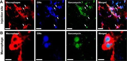 Figure 7 In vivo cellular internalization of fluorescently labeled gelatin nanospheres (GNs, blue) and fluorescent-labeled vancomycin (green) by fluorescent zebrafish macrophages (red) at 24 hours after intramuscular injection of vancomycin-loaded GNs into a 1-day-old zebrafish larva. (A) Interactions between zebrafish macrophages and vancomycin-loaded GNs observed in the muscle tissue surrounding the injection site. The white arrows point at vacuole-like structures of macrophages containing internalized gelatin nanospheres and vancomycin. (B) High magnification of a zebrafish macrophage containing the internalized gelatin nanospheres and vancomycin. Scale bars in A and B represent 50 and 10 μm, respectively.