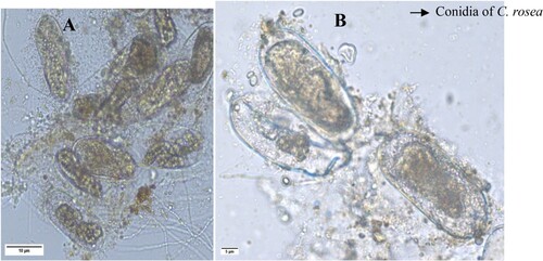 Figure 1. Effect of C. rosea on M. incognita egg parasitization. (A) Penetration of C. rosea TNAU CR 01 mycelium. (B) Infected eggs with spores of C. rosea TNAU CR 01.