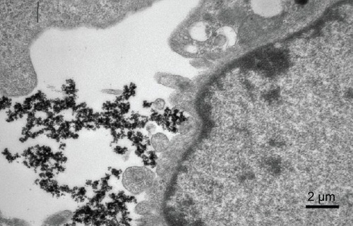 Figure 8 Transmission electron micrographs of chitosan-coated Fe3O4 nanoparticles attached to cell surfaces.