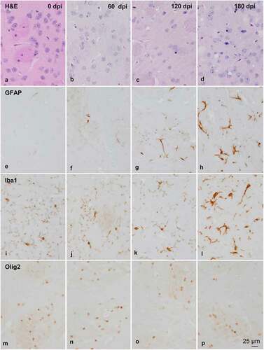 Figure 2. Morphology and immunohistochemistry of the striatum in tg340 control and tg340 sCJD MM1-inoculated mice at 0, 60, 120 (preclinical), and 180 (clinical stage) days post-inoculation (dpi). A few vacuoles consistent with spongiform change are first seen in haematoxylin and eosin (H&E) stained sections at 120 dpi, and their number increases at 180 dpi (a-d). This is accompanied by a moderate, non-significant increase, in the number of reactive astrocytes and microglia at 120 dpi, and with marked increase of GFAP-immunoreactive cells (e-h) and microglia (Iba1-positive cells) (i-l) at 180 dpi. The number of oligodendrocytes, as revealed with the Olig2 antibody, shows a trend to decrease in the intrastriatal fibres at 180 dpi (m-p). The immunoreactivity to proteolipid protein 1 (PLP1) is preserved at 180 dpi (q-t). Nevertheless, some intrastriatal fascicles show focal, cotton-like decrease of myelin basic protein (MBP) immunoreactivity at the same time-point (u-y). These alterations occur in parallel with the presence of PrPres immunoreactivity. A few punctate PrPres deposits are seen at 120 dpi; a diffuse synaptic-like PrPRes immunostaining are found at 180dpi (z). Paraffin sections lightly counterstained with haematoxylin, A-P, bar = 25 μm; Q-Y, bar = 100 μm; Z, bar = 25 μm