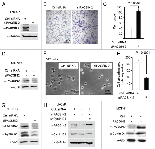 Figure 3 Knockdown of PACSIN 2 reduced cell migration. (A) Prostate cancer cells, LNCaP, were transiently transfected with PACSIN 2 siRNA (siPACSIN 2). 72 hr after transfection, western blot was conducted for PACSIN 2 protein. Actin was included as protein loading control. (B) Transwell migration assays were performed with cells transfected with either control siRNA (Ctrl. siRNA) or siPACSIN 2. (C) Quantitative analysis of trans-migrated cells. (D) 3T3 cells were assessed for cell spreading. Cells transfected with siPACSIN 2 have reduced cell spreading phenotype. (E) Quantitative analysis of cell spreading (arbitrary unit). (G and H) NIH 3T3 and LNCaP cells were transiently transfected with siPACSIN 2 or control. Western blot was performed to determine the expression of cyclin D1 and PACSIN 2. (I) MCF-7 cells were transfected vector encoding PACSIN 2. GDI and β-actin served as protein loading control.