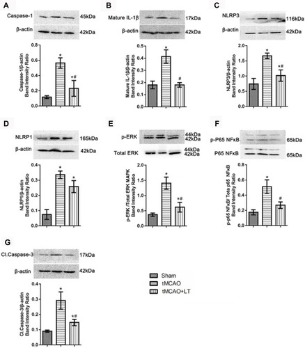 Figure 4 Effect of the transplantation of lymphocytes co-cultured with HCB-SCs on the inflammatory activity. Western blot shows the protein levels of caspase-1 (A), mature IL-1β (B), NLRP3 (C), NLRP1 (D), p-ERK/ERK (E), NF-κB p-P65/P65 (F), and cleaved caspase-3 (G). The NF-κB specific band is located at 65 kDa, and a nonspecific band can be seen at a molecular weight of 72 kDa (F). *P<0.05 vs Sham group; #P<0.05 vs tMCAO group.