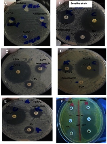 Figure 1 Antibiotic–EPI disc synergy test using antibiotic discs combined with CCCP or ketoconazole as EPIs. (A) Antibacterial activity of methanol (used for dissolving CCCP), of dimethyl sulfoxide (DMSO) used as a solvent for ketoconazole, of CCCP, and of ketoconazole (each alone). (B) Norfloxacin (NOR)-sensitive Staphylococcus aureusshowing no change in zone diameter in combination with ketoconazole. Addition of CCCP to antibiotic disc showed an increase in zone diameter due to its antibacterial activity. (C–E) CCCP and ketoconazole increase the activity of the tested antibiotics. (F) Effect of ketoconazole on the addition of ceftriaxone (CRO), oxacillin (OX), and amoxicillin/clavulanic acid (AMC) discs.Abbreviations: CCCP, carbonyl cyanide m-chlorophenylhydrazone; FOX, cefoxitin; KET, ketoconazole; LEV, levofloxacin.