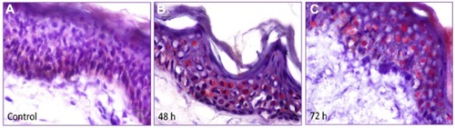 Figure 1 Human skin penetration of empty phosphatidylcholine liposomes.