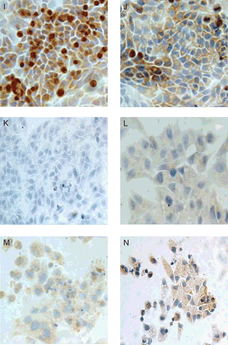 Figure 4.  Matrine down-regulated the expression of C-myc, Bcl-2, and up-regulated the expression of Bax. HepG2 cells cultured in DMEM (upper row, I, J, K) or DMEM containing 0.8 mg/mL matrine (lower row, L, M, N) for 2 days were detected with immunostaining. HepG2 cells were viewed under multifunctional microscope (×400magnification). Expression of C-myc (first column) and Bcl-2 (second column) were seen in the cell nucleolus and cytoplasm of matrine-treated cells and the staining intensity was weaker than that of untreated cells. Bax (third column) expressed stronger than untreated cells. The mean grade of staining intensity was higher compared with control cells.