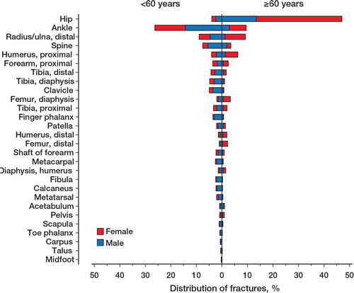 Figure 4. Distribution of fractures between women and men who were younger and older than 60 years of age.
