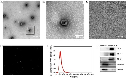 Figure 2 Characterization of hucMSC-Exos. (A) TEM photograph of hucMSC-Exos with negative staining using 2% uranyl acetate. (B) Enlarged view of the selected area (black box) in the image (A). (C) Cryo-TEM photograph of hucMSC-Exos. (D) NTA video image of hucMSC-Exos’ movement under Brownian motion. (E) Size distribution measurement of hucMSC-Exos by NTA analysis. (F) Western blot analysis of protein markers of hucMSC-Exos.