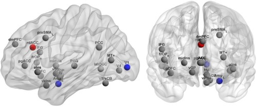 Figure 1 Brain regions in the emotion network showing significant differences on ALFF between the Alex and the HC groups.