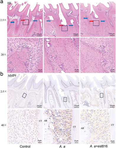 Figure 4. H&E staining and immunohistochemical analysis of MMP-9 in periodontal tissues. (a) H&E staining evaluating the inflammatory response of periodontal tissues in the region of the first and second molars of rats for 2 months (original magnification × 2.5 and × 20; blue and red arrows pointing root bifurcation and alveolar crest, respectively; the black boxes represent the magnification area). (b) Immunohistochemical analysis exhibiting MMP-9 expression in periodontal tissues in the region of the first and second molars of rats for 2 months; (original magnification × 2.5 and × 40; AB points to alveolar bone; CT points to cementum).