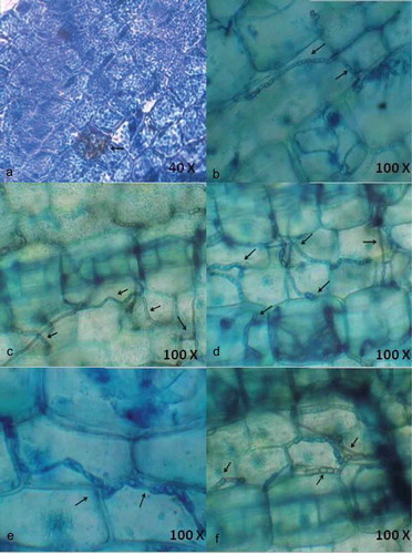 Figure 2. Localisation of endophytic fungi within seagrass tissue using Aniline blue (a) and lactophenol cotton blue (b-f) staining indicating the presence of septate fungal hyphae traversing the cells and forming network.