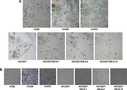 Figure 1 Morphologic differences of NSCLC cell lines.