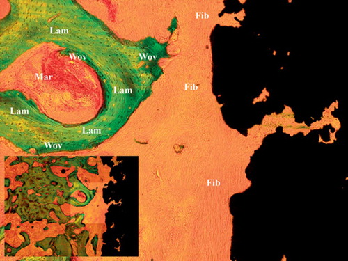 Figure 2. Characteristic histomorphometry of control implant with fibrous tissue covering the implant surface. Wov: woven bone; Lam: lamellar bone; Fib: fibrous tissue; Mar: marrow space.