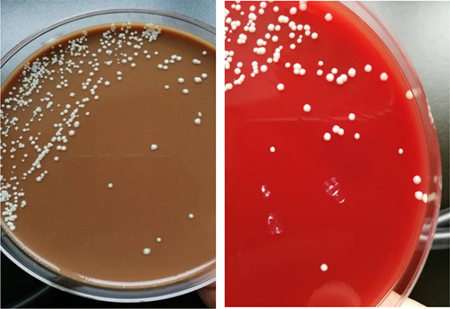 Figure 2 Mucoid cream-colored colonies on agar and blood agar from puncture fluid specimens, which were identified as Mycobacterium abscessus by PCR and mass spectrometry analysis.
