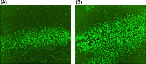 Figure 2. Green fluorescence distribution after HEK293A cells were transfected with the adenoviral vector (× 40). (A) Expression of green fluorescence protein after HEK293A cells were transfected with VEGF165 adenoviral vectors. (B) Expression of green fluorescence protein after HEK293A cells were transfected with empty adenoviral vectors.