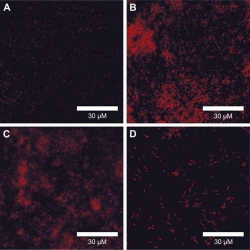 Figure 5 Fluorescence microscopy imaging of clinical resistant strain of Pseudomonas aeruginosa.Notes: Microscopic results show a PI assay of the clinical resistant strain of P. aeruginosa treated with Ag-NPs at the following concentrations: (A) 0, (B) 0.5 MIC, (C) 1 MIC, and (D) 2 MIC.Abbreviations: Ag-NPs, silver nanoparticles; MICs, minimum inhibitory concentration; PI, propidium iodide.