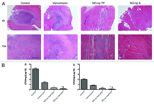 Figure 2. NO-nps effectively kill MRSA and limit muscular infection damage. (A) Histological analysis of Balb/c mice untreated, Vancomycin treated, NO-np TP treated, and NO-np IL treated MRSA-infected intramuscular abscesses on day 4. Mice were intramuscularly infected with 107 MRSA. Representative H&E-stained sections of the skin lesions are shown with the Scale bars: 4X: 25 mm; 10X: 10 mm. (B) Abscess bacterial burden (CFU; colony forming units) in mice infected subcutaneously with 107 MRSA and treated with NO-np is significantly lower than untreated or np-treated mice (n = 12 abscesses per group) as well as vancomycin treated. The percent survival at days 4 (a) and 7 (b) was tabulated based on CFU/gm abscess and compared with control. Error bars denote standard deviations. Symbols denote P value significance calculated by analysis of variance and adjusted by use of the Bonferroni correction. *p = 0.0001, for comparisons of NO-np IL or TP compared with vancomycin. ϕp = 0.001, for comparison of NO-np IL to NO-np TP at day 4. #p = 0.045, for comparison of NO-np IL to NO-np TP at day 7.