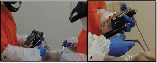 Figure 1. Minimally invasive autopsy – Videoscope Guided – A. Two healthcare persons with personal protective equipment (PPE) during autopsy procedure B. Videoscope (MScope, Karl-Storz Optical 4 mm, 30º) attached to a smartphone for visual inspection and sampling removal