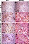 Figure 7 Immunohistochemical expression of caspase-3 in liver and kidney sections in different groups showing negative caspase-3 expressions in control negative group (A and B). Strong positive caspase-3 reactions in the group treated with 50 mg/kg bwt Ch-AgNPs (C and D). Moderate positive caspase-3 reaction in the group treated with 25 mg/kg bwt Ch-AgNPs (E and F). Mild positive to negative caspase-3 expression in the group treated with 10 mg/kg bwt Ch-AgNPs (G and H).Abbreviations: bwt, body weight; Ch-AgNPs, chitosan-coated silver nanoparticles.