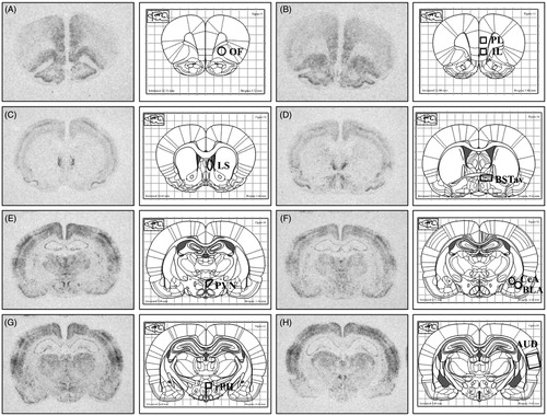 Figure 5. Representative autoradiographs of c-fos mRNA with corresponding atlas images (Paxinos and Watson). These representative autoradiographs indicate the regions quantified, as well as the template size, shape, and placement used in analysis. (A) Orbitofrontal cortex (OF). (B) top: Prelimbic cortex (PL), bottom: Infralimbic cortex (IL). (C) Lateral Septum (LS). (D) Antero-ventral bed nucleus of the stria terminalis (BSTav). (E) Paraventricular nucleus of the hypothalamus (PVN). (F) top/medial: Central nucleus of the amygdala (CeA), bottom/lateral: Basolateral nucleus of the amygdala (BLA). (G) Rostral posterior hypothalamus (rPH). (H) Auditory cortex.