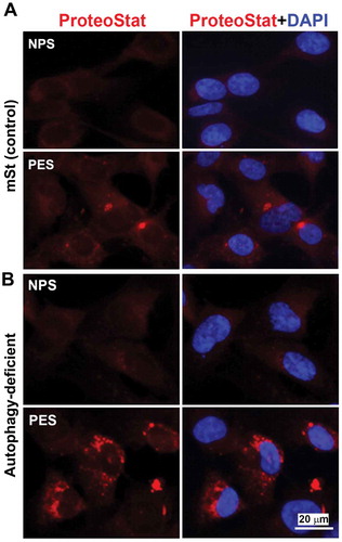 Figure 8. Evidence for accumulation of ProteoStat-positive protein aggregates in autophagy deficient EVTs in response to gestational age matched sera from NP and PE women. Autophagy deficient ATG4BC74A cells and autophagy proficient control cells (mSt) were grown in FBS-free media supplemented with 10% NPS or PES for 24 h and then stained with ProteoStat. Images are representative of independent experiments using six serum samples from each. Bar: 20 µm.
