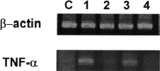 Figure 7. TNF-α mRNA expression in renal cortical tissues of rabbits treated with cisplatin, cisplatin + pentoxifylline (PTX), lipopolysaccharide (LPS), and LPS + PTX. Total RNAs were isolated from the kidney cortex of animals treated with cisplatin or lipopolysaccharide with or without PTX pretreatment. C, normal control; lane 1, cisplatin; lane 2, cisplatin plus PTX; lane 3, lipopolysaccharide; lane 4, lipopolysaccharide plus PTX.