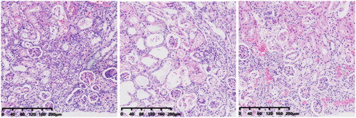 Figure 11. Colon pathology after FMT intervention (from left to right, CS, CSF, FS).