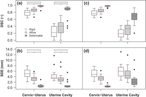 Figure 2. Box-and-whisker plots of the DSC and the SDE between the MR image and the pathology photo (a, b) and between adjacent MR images and the pathology photo (c, d) after each step in the three-step multi-image registration strategy (rigid registration, affine registration and deformable registration) for the cervix-uterus and the uterine cavity structure. The box represents the upper and lower quartiles (IQR) and the band (red) inside the box the median value. The whisker represents the highest (lowest) value within 1.5 IQR of the upper (lower) quartile. Dots above or below the whiskers are considered outliers. Horizontal lines indicate statistical significant difference (p < 0.01).