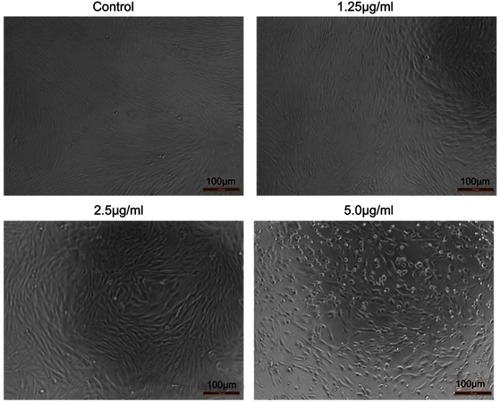 Figure 5 Effects of cuprous oxide nanoparticles (CONPs) on HSFs. The proliferation of HSFs was significantly inhibited after treated with different concentrations of CONPs. Cells treated with CONPs grew slow, floating with a spherical shape, while cells in control group were spindle and grew quick.