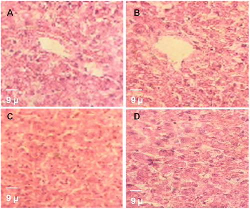 Figure 4. Paraffin sections stained by haematoxylin and eosin (H&E) for histopathological examination of liver tissues of rats as follows: (A) the control rats; (B) rats fed with RA (10 mg/kg); (C) rats fed with RA (50 mg/kg) and (D) rats fed with RA (100 mg/kg). Normal histological structures are depicted in these pictures.