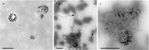 Fig. 3.  Representative images of EVs from (a) PFP and (b, c) 100k-PFP sedimented onto electron microscopy grids after Anx5-gold labelling. (a) Isolated Anx5-positive EVs are observed, with no EV aggregates. (b) An EV aggregate, about 800 nm in overall size, is observed, together with isolated EVs (arrows). (c) High magnification view of the dashed box from b; the EV aggregate contains Anx5-positive and Anx5-negative EVs. Scale bars: 500 nm.