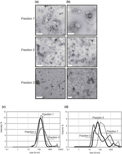 Figure 2. Transmission electron microscopy (a + b) and dynamic light scattering (b + c) of frontal cortex vesicles. Vesicle fractions 1–3 were visualized by negative-staining transmission electron microscopy: (a) scale bar represents 500 nm or (b) 200 nm. TEM is representative of 5 images taken of each fraction from 30 independent human tissue samples. To further corroborate the diameter of the vesicles, fractions were subject to dynamic light scattering to determine the relative size distribution. DLS signal intensity (c) was transformed to percentage volume distribution (d). The thin black line represents F1, thick black like F2 and thick grey line F3. The analysis was performed in size mode with all measurements made in triplicate. An average of three independent tissue samples is shown.