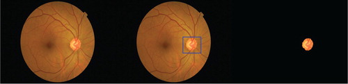 Figure 11. OD obtained by method 2 for images from private dataset.