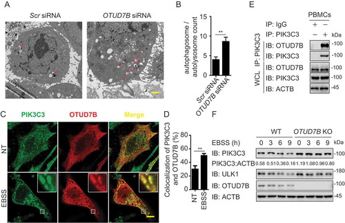 Figure 6. OTUD7B targets PIK3C3 to promote its degradation. (a-b) Electron microscopy observation (a) of ultra-structure of the cells. HeLa cells transfected with scramble or OTUD7B siRNA are treated with rapamycin (250 nM) for 18 h before analysis. Arrows indicate autophagosomes or autolysosomes. Scale bar, 2 μm. Quantification (b) of autophagosomes and autolysosomes per cell after rapamycin treatment. (c-d) Confocal microscopy (c) and quantitative data (d) of HeLa cells treated with MG132 at basal level or incubated in EBSS medium for 1 h. Scale bar, 20 μm. (e) co-IP and immunoassay of cell extracts of PBMCs treated with EBSS for 1 h. (f) Immunoassay of extracts of WT and OTUD7B KO HEK293 T cells cultured in EBSS medium for the indicated time points (above lane). Data are representative of three independent biological experiments. Data in (a-d) are expressed as means ± SEM of three independent biological experiments (20 cells per sample). *p < 0.05, **p < 0.01, ***p < 0.001; ns, not significant (two-tailed Student’s t-test)