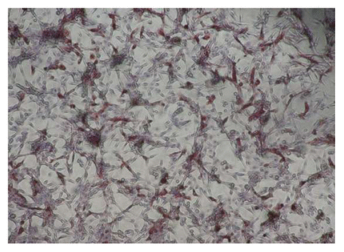 Figure 2. Showing 50% end point dilution in the immunohistochemistry based test. Note the presence of dark brown inclusions representing rabies nucleoprotein in approximately 50% of BHK 21 cells (×400).