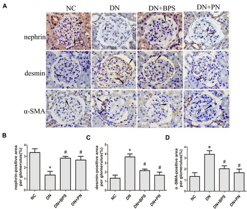 Figure 6 Effects of PN treatment on nephrin, desmin, and α-SMA expression in diabetic rats detected by immunohistochemistry staining (magniﬁcation 400×). Representative photomicrographs of immunostaining for nephrin, desmin, and α-SMA (A) in kidney sections. Semiquantitative analyses of immunostaining for nephrin (B), desmin (C) and α-SMA (D) per glomerulus. PN and BPS were administered once daily by oral garage for 12 weeks. Results were expressed as the mean ± SEM. The arrow represents protein expression of nephrin, desmin, and α-SMA in diabetic rats glomerular.*P<0.05 vs NC; #P<0.05 vs DN.