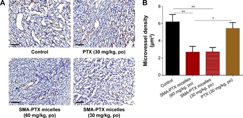 Figure 6 Microvessel density in tumors from mice treated with oral PTX and SMA-PTX micelles.Notes: (A) Representative pictures of CD105 staining from tumor sections of all treatment groups. The scale bar denotes 100 μm. (B) Microvessel density in tumor sections from the treatment groups. Values are expressed as mean ± SEM. n=7 for all the treatment groups. Data were analyzed by one-way ANOVA coupled with Bonferroni post hoc test with *P<0.05 and **P<0.01 as the required statistical significance.Abbreviations: PTX, paclitaxel; SMA, poly(styrene-co-maleic acid); SEM, standard error of the mean; ANOVA, analysis of variance.