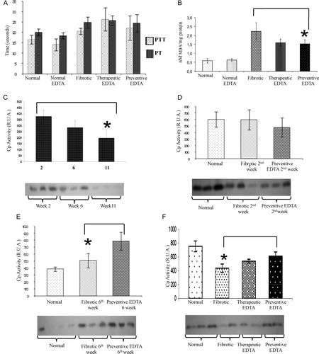 Figure 3. Coagulation times, lipid oxidation (MDA), and ceruloplasmin curve. (A) Coagulation times of different treated groups. PTT and PT were analyzed. There were no significant differences between fibrotic and EDTA-treated animals. (B) Lipid peroxidation measurement by the MDA technique. Significant decrease in lipid peroxidation was observed in fibrotic animals treated with EDTA (60 mg/kg) in the preventive and therapeutic EDTA groups with respect to fibrotic control. (C) Activity of Cp at 2, 6, and 11 weeks of CCl4 treatment. Cp activity diminished gradually in serum concomitantly with time of CCl4 insult. (D) Activity of Cp at 2 weeks of CCl4 intoxication with or without concomitant administration of EDTA (60 mg/kg). EDTA treatment groups maintained Cp activity even in the presence of a continued administration of CCl4. (E) Activity of Cp at 6 weeks of CCl4 intoxication with or without concomitant administration of EDTA (60 mg/kg). As the time of intoxication advanced, Cp activity increased in the EDTA-treated group (62%). (F) Cp activity in therapeutic and preventive groups. EDTA treatment is associated with increased Cp activity. The Cp activity in the normal EDTA group was not statistically different with respect to the normal group in all assays (data not shown). Cp activity was determined by zymography assay. Activities in the gel slabs were quantified (relative units area) using an image analyzer system (Kodak 1D 3.5 image analyzer). Values are the mean ± standard deviation of the mean of five rats per group. Asterisks indicate values significantly different (*P ≤ 0.05).