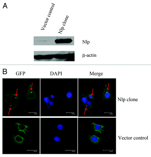 Figure 1. Nlp locates in centrosome. (A) The identification of transfected cell lines: MCF-7 breast cancer cell line was transfected by pEGFP-C3 and pEGFP-Nlp respectively. Nlp clones and control were detected by protein gel blot analysis. β-Actin was used as an internal standard to indicate equal loading for each clone. (B) The localization of Nlp in centrosome was shown by immunofluoresent approach (red arrow marked bright green points).
