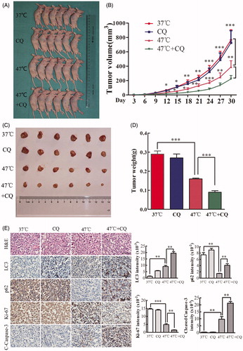 Figure 6. Inhibition of autophagy by CQ significantly enhances the antitumor effects of heat treatment in vivo. (A–D) SMMC7721 cells pretreated at 47 °C for 30 min or maintained at 37 °C were subcutaneously injected into the upper right flank of nude mice, treated with or without CQ and tumor size was measured. Mice were sacrificed 30 d after implantation (A). Tumor growth was measured every 3 d for 30 d, and the results were plotted (B). Tumors were harvested, photographed (C) and weighed, and the results were plotted (D). (E) Representative images of H&E and IHC staining. The levels of LC3, p62, Ki-67 and cleaved Caspase-3 were examined by IHC staining and quantified with Image-Pro Plus software. Scale bar, 100 μm. Each experiment was repeated three times and representative images are shown. Error bars represent the SEM. *p < .05, **p < .01 and ***p < .001.