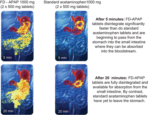 Figure 2.  Representative scintigraphic images in one subject showing gastric emptying at 5 and 20 min after both study treatments.