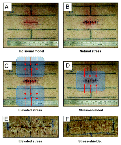 Figure 1. Incisional model in the red Duroc pig. (A) Tattoo lines to mark incision. (B) Creation of full thickness 3 cm incision on post-injury day 0. Wounds were immediately closed with nylon sutures. “Natural stress” wounds were allowed to heal without any modulation of the mechanical environment. (C) Schematic of device positioning for the “elevated stress” wound conditions. The “para” positioning of the devices results in elevated mechanical forces (red arrows) as the polymer device contracts parallel to the long axis of the wound. (D) In the “stress-shielded” wounds, incisions were mechanically offloaded by placing the device overlying the wound. As the device contracts parallel to the long axis of the wound, adjacent mechanical forces are offloaded (red arrows). Photographs at eight weeks post-injury of incisional wounds that healed under elevated stress (E) vs. stress-shielded (F) conditions. Histologic validation of scar properties has been previously published.Citation28 Scale bar = 1 cm.