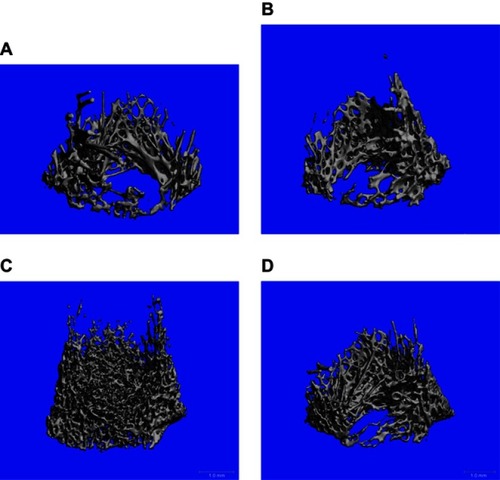 Figure 1 Distal femur analyzed by high-resolution peripheral quantitative computed tomography compariing control (A) and treated groups of mesenchymal stem cells (B), osteoblasts (C), and exosomes (D).