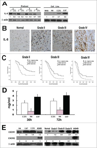 Figure 1. IL-8 expression in glioma tissues and cell lines. (A) Left, Expression of IL-8 protein in paired glioma tissues (T) and adjacent non-tumor tissues (ANT), with each pair obtained from the same patient. Right, Expression of IL-8 protein in cultured glioma cell lines(normal human astrocytes (NHA) cells, H4, U251 and U87). β-actin was used as a loading control. Quantification of relative protein levels is shown below the blots. The results were from a representative of at least 3 repeated experiments. (B) Expression of IL-8 protein in normal brain tissue and glioma tissues (grade II, grade III and grade IV) was examined by immunohistochemical staining, scale bar: 20 um. (C) The statistical significance of the difference between curves of IL-8 high-expressing (dotted line) and low-expressing (bold line) patients was compared within subgroups of WHO grade II, grade III and grades IV. P values were calculated by the log-rank test, P < 0.05 was considered statistically significant. (D) Glioma cells secrete IL-8 in the complete media. Three different types of glioma cell lines were plated in 96 well plates and culture media was collected at the end of 36 and 72 h for ELISA measurement. The results were from a representative of at least 3 repeated experiments. (E) Expression levels of CXCR1 and CXCR2 protein in glioma cell lines (H4, U87, U251) and in normal brain tissue and glioma tissues (grade II, grade III and gradeIV) were detected by Western blot. A549 cell line was used as a positive control, β-actin was used as a loading control. Quantification of relative protein levels is shown below the blots. The results were from a representative of at least 3 repeated experiments.