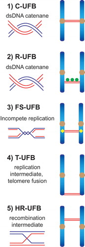 Figure 1. Schematic diagram indicating the five types of anaphase UFBs. (1) Centromeric UFBs (C-UFBs) emerge from centromeres, possess double-stranded catenanes, and can be induced by inhibition of topoisomerase IIα by ICRF-193. (2) Ribosomal UFBs (R-UFBs) emerge from catenated rDNA and are marked by UBF (green circles). (3) Fragile site UFBs (FS-UFBs) emerge from incompletely replicated DNA at CFSs and are flanked by FANCD2 twin foci (yellow rhombus). They can be induced by DNA polymerase inhibitors (e.g. aphidicolin) that induce replication stress. (4) Telomeric UFBs (T-UFBs) originate from telomeric regions and can be induced by replication stress and/or overexpression of the shelterin protein TRF2 leading to telomere fusions. (5) Homologous recombination UFBs (HR-UFBs) originate from unresolved recombination intermediates. They can be induced by inhibition of GEN1 and MUS81, two nucleases that mediate Holliday junction resolution, or by depletion of 53BP1 which leads to upregulation of homologous recombination.