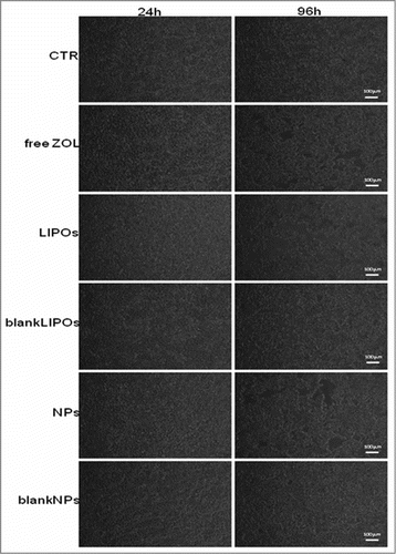 Figure 9. Representative time-lapse images show the progression of cytotoxic effect on a monolayer of DU 145 throughout the entire experiment. Cells treated with LIPOs were lysed more than other. Scale bar, 100 μm. For the kinetic analysis of the data please see also movies added to the present manuscript as supplemental files available on the web site of the journal. Legend: CTR3.avi: Untreated cells; AZ9.avi: ZOL-treated DU145 cells; Lip17.avi: LIPO-ZOL-treated DU145 cells; Nano33.avi: NP-ZOL-treated DU145 cells.