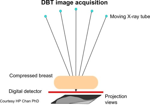 Figure 2 Diagram of the digital breast tomosynthesis (DBT) system.
