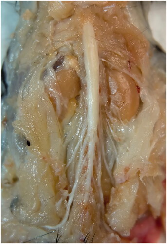 Figure 2. Harvest of the spinal cord (spinal nerve roots remained).