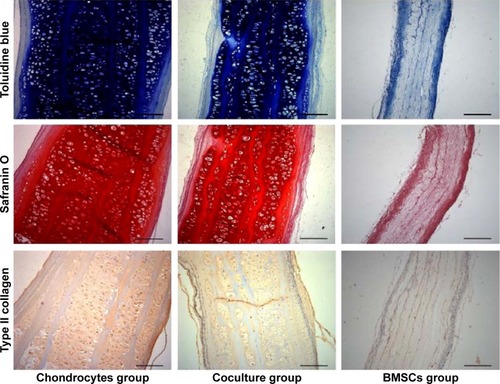 Figure 5 Special histological staining with Toluidine blue and Safranin O and immunohistochemistry staining with type 11 collagen for cell-scaffold constructs in the different groups.Note: Scale bars: 200 μm.Abbreviation: BMSC, bone marrow stromal cell.